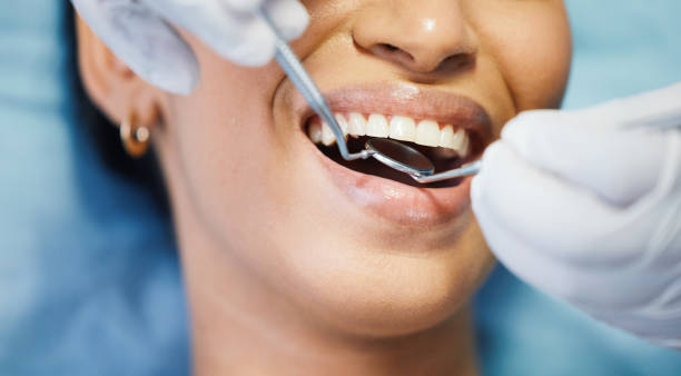 Best Emergency Tooth Extraction in St Croix Falls, WI