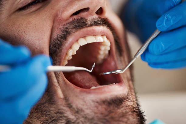Best Emergency Treatment for Toothache in St Croix Falls, WI