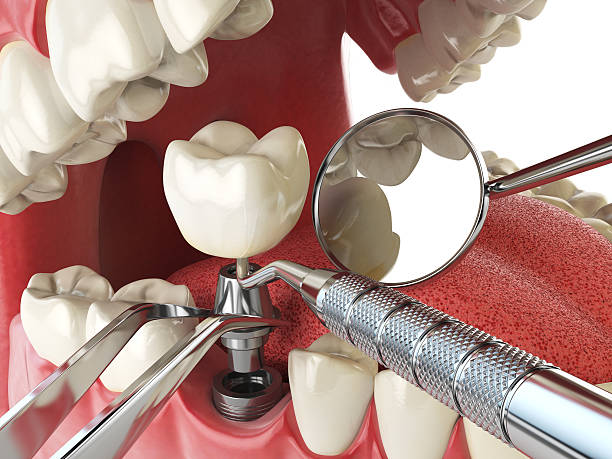 Best Emergency Dental Care for Trauma or Injury in St Croix Falls, WI